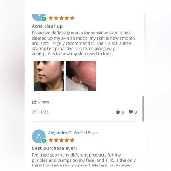 🏷️🏷️Proactiv Revitalizing Toner 6ml, Repair 3ml, Pore Targeting Treatment NEW! - Picture 5 of 13